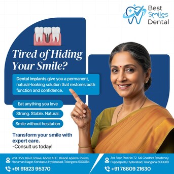 Hyderabad, Dental, Best Dental Implants In Kondapur- Best Smiles Dental, Hyderabad
