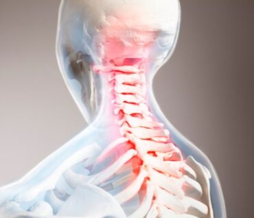 Gurgaon, Businesses For Sale, Advanced Cervical Spondylosis Treatment In Gurgaon