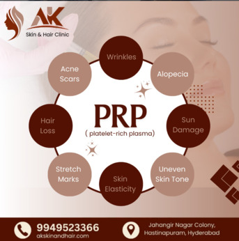 Hyderabad, Health, Get Advanced Hair Restoration With Expert Care In Hyderabad