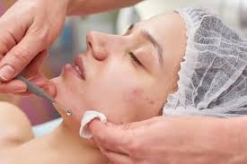 Ghaziabad, Health, Best Acne Treatment In Gaur City