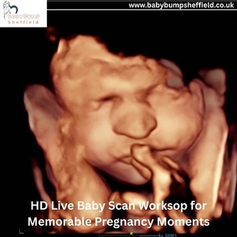 London, Health, HD Live Baby Scan Worksop For Memorable Pregnancy Moments