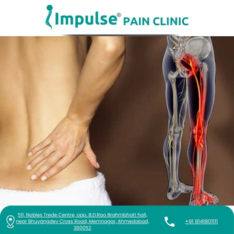 Ahmedabad, Health, Safe & Effective Solution For Sciatica Pain Treatment In Ahmedabad
