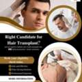 Hair Transplant In Baner - The Aesthetic Hub