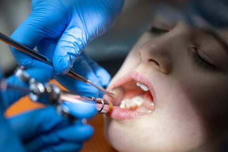 New York, Dental, Expert Tooth Extraction In Beverly Hills | Safe & Gentle Care