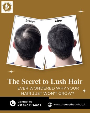 Pune, Medical, Hair Loss Treatment In Baner- The Aesthetic Hub