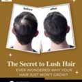 Hair Loss Treatment In Baner- The Aesthetic Hub