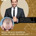 Best Hair Transplant In Baner - The Aesthetic Hub