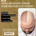 Permanent Hair Transplant In Baner - The Aesthetic Hub