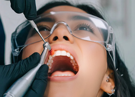 Bangalore, Dental, Best Teeth Cleaning & Polishing Clinic In Panduranga Nagar