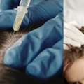 Complete Guide To Effective Hair Care Solutions In Ahmedabad