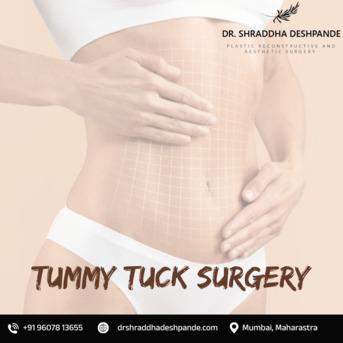 Mumbai, Health, Best Tummy Tuck Surgery In Mumbai By Dr. Shraddha Deshpande