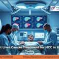 Best Liver Cancer Treatment For HCC In India Today