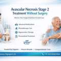 Avascular Necrosis Stage 2 Treatment Without Surgery &ndash; HipXpert