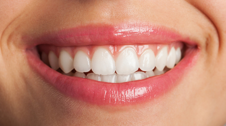 Mumbai, Dental, Teeth Whitening Solutions For Sensitive Teeth