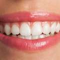 Teeth Whitening Solutions For Sensitive Teeth