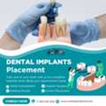 How Safe Is Dental Implants Placement?