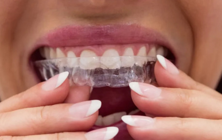 Pune, Dental, Best Invisalign Cost In Pune​