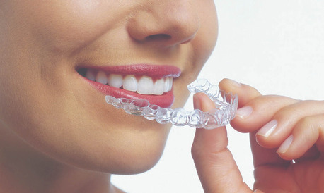 Pune, Dental, Best Invisalign Cost In Pune​