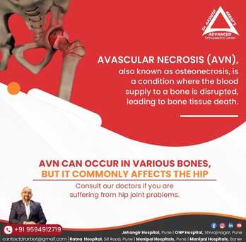 Pune, Health, AVN Treatment In Sangamvadi Pune-  Dr. Aashish Arbat