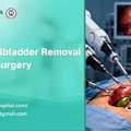 Robotic Gallbladder Removal Surgery