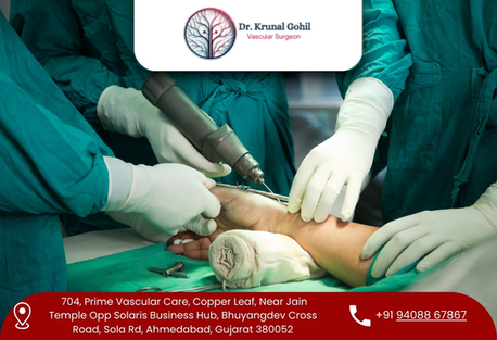 Ahmedabad, Health, Trusted Specialist For Vascular Treatment In India