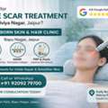 INR 2500,  Best Acne Scar Treatment Near Malviya Nagar, Jaipur