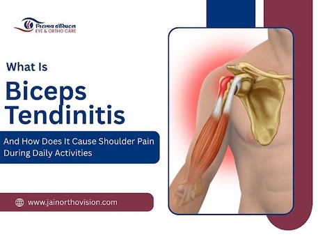 Mumbai, Health, Effective Biceps Tendinitis Care And Shoulder Pain Solutions