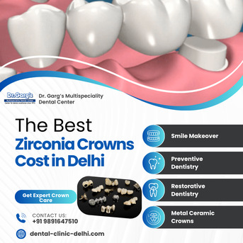 New Delhi, Dental, Best Zirconia Crowns Cost In Delhi At Dr. Garg&rsquo;s Multispeciality Dental Center