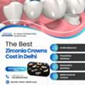 Best Zirconia Crowns Cost In Delhi At Dr. Garg&rsquo;s Multispeciality Dental Center