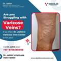 Effective Vein Treatment For Better Comfort And Mobility