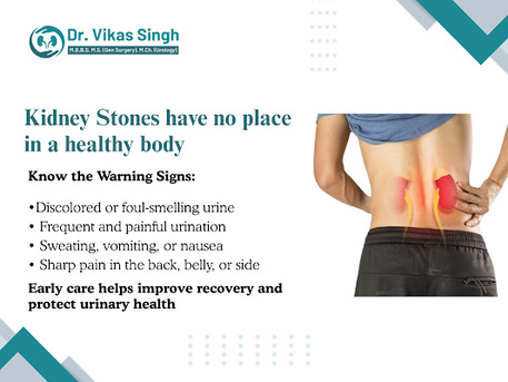 Indore, Health, Signs Of Kidney Stones And When To Seek Treatment Early
