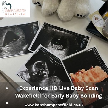 London, Health, Experience HD Live Baby Scan Wakefield For Early Baby Bonding