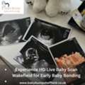 Experience HD Live Baby Scan Wakefield For Early Baby Bonding