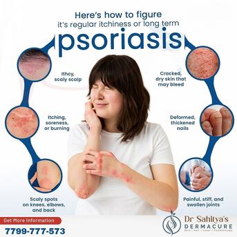 Kurnool, Health, Psoriasis Signs And Management- Dermacure Clinic
