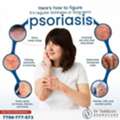 Psoriasis Signs And Management- Dermacure Clinic