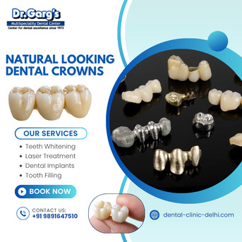 New Delhi, Dental, Natural Looking Dental Crowns At Dr. Garg&rsquo;s Multispeciality Dental Center