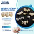 Natural Looking Dental Crowns At Dr. Garg&rsquo;s Multispeciality Dental Center
