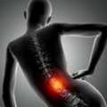 Non-Surgical Back Pain Treatment Treatment In Dallas