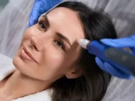 New York, Health, Microneedling Treatment Near Me For Radiant Skin
