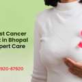 Need Breast Cancer Treatment In Bhopal Choose Expert Care Today