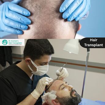 Hyderabad, Health, Advanced Hair Transplant In Kondapur For Receding Hairlines