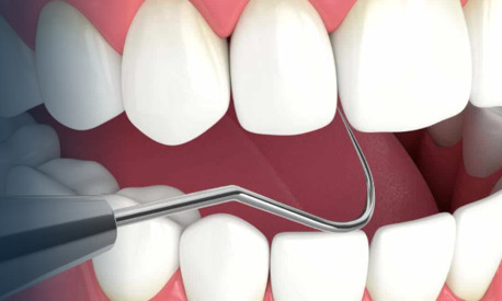 New York, Business, Full Mouth Reconstruction Advanced Smile Restoration At Stadium Dental & Orthodontics