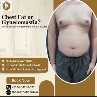 Pune, Medical, Male Breast Reduction In Baner - The Aesthetic Hub