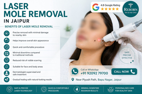 Jaipur, Health & Beauty Items, INR 2000,  Laser Mole Removal In Jaipur - Scar-Minimizing Treatment Near You