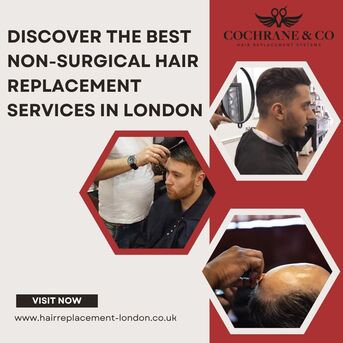 London, Business, Discover The Best Non-Surgical Hair Replacement Services In London