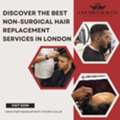 Discover The Best Non-Surgical Hair Replacement Services In London