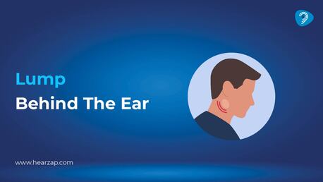 Hyderabad, Health & Beauty Items, INR 50000,  Lump Behind The Ear: Causes, Symptoms & Treatment