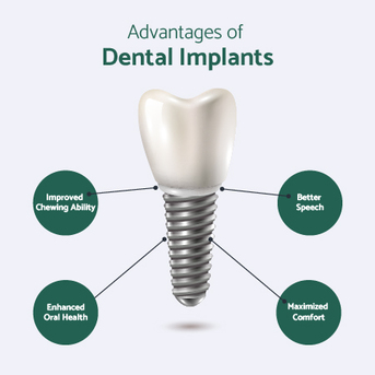 San Diego, Health, Dental Implant Cost