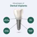 Dental Implant Cost