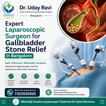 Bangalore, Health, Expert Laparoscopic Surgeon For Gallbladder Stone Relief In Bangalore - Dr. Uday Ravi.